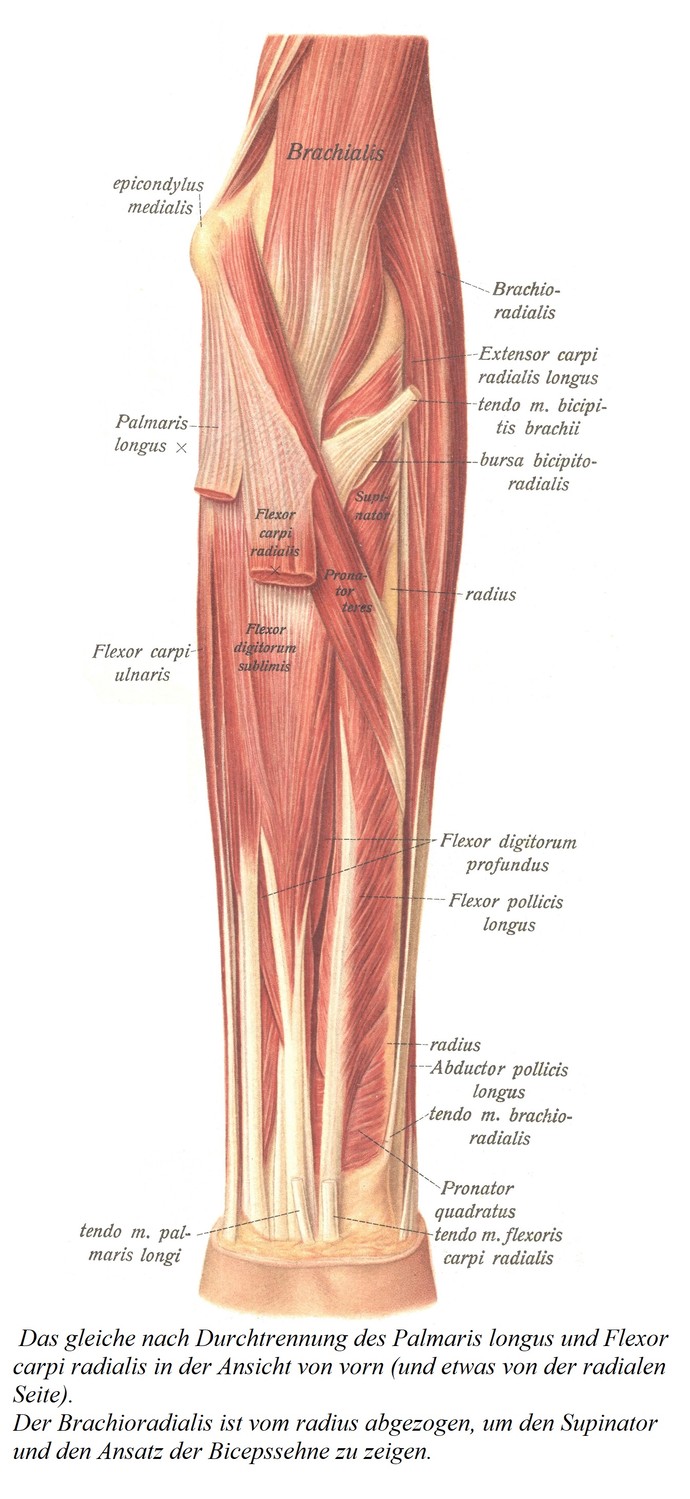 Поверхностный слой мышц после пересечения длинной ладонной мышцы и лучевого сгибателя запястья, вид спереди (и несколько с лучевой стороны). Плечелучевая мышца вычитается из лучевой кости, чтобы показать супинатор и место прикрепления сухожилия бицепса.
