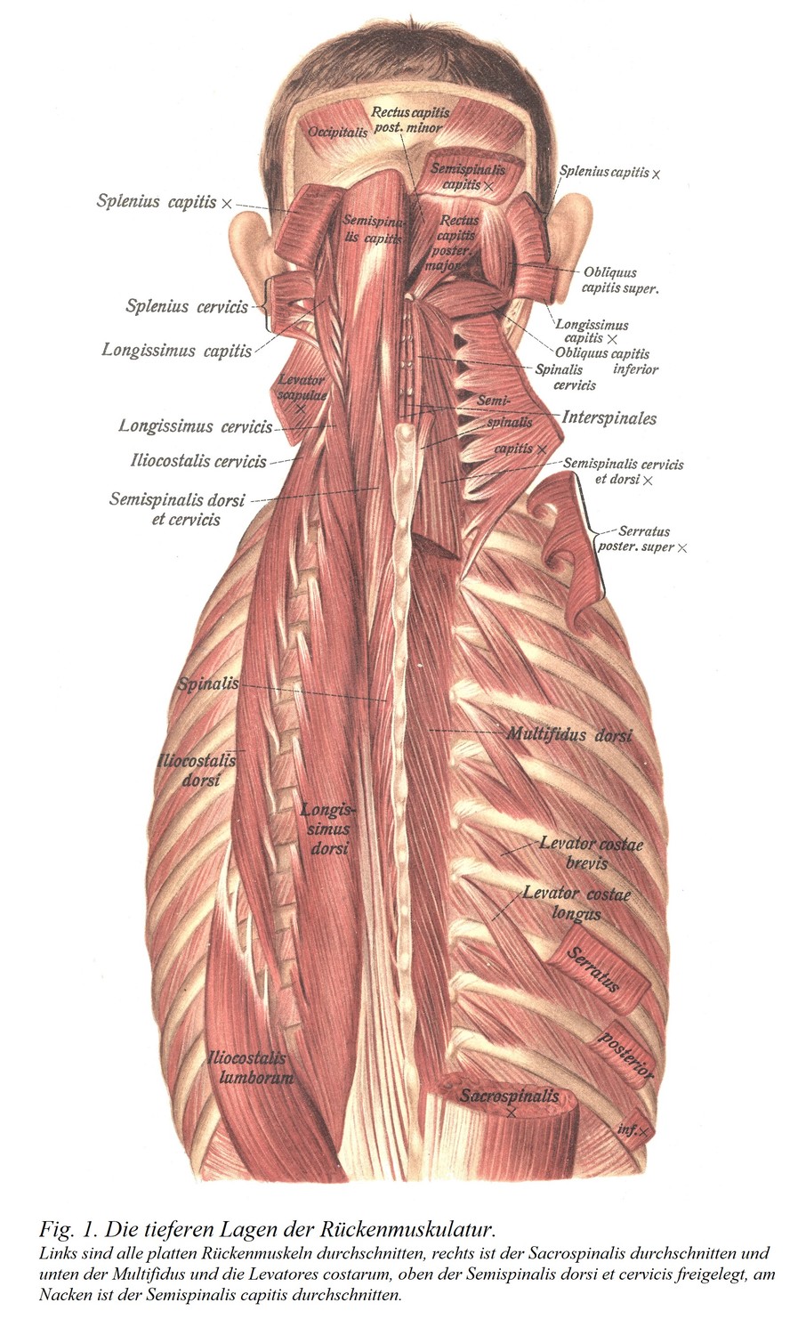 Глубокие слои мышц спины. Все плоские мышцы спины пересекаются слева, крестцово-остистая мышца пересекается справа, а снизу обнажаются многораздельная и поднимающая ребра мышцы, сверху обнажаются полуостистая мышца спины и шейки матки и полуостистая мышца головы пересекается на шее.