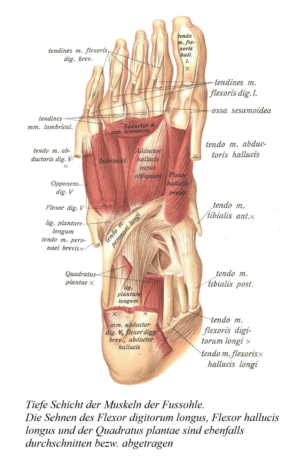Глубокий слой мышц подошвы стопы. Сухожилия длинного сгибателя пальцев, длинного сгибателя большого пальца стопы и квадратной мышцы стопы также перерезаны. 