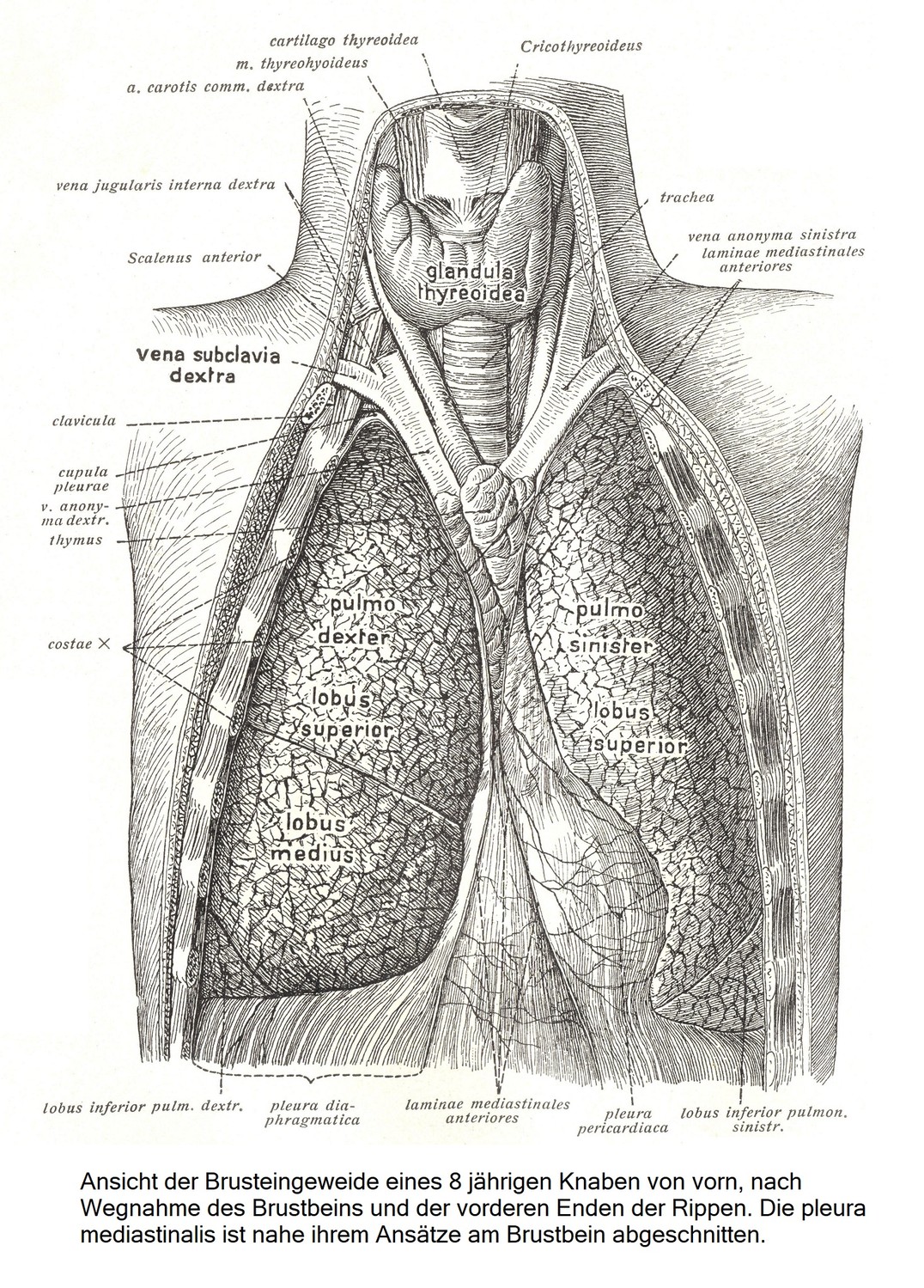 Вид спереди внутренних органов грудной клетки 8-летнего мальчика после удаления грудины и передних концов ребер. Медиастинальная плевра отсекается в месте ее прикрепления к грудине