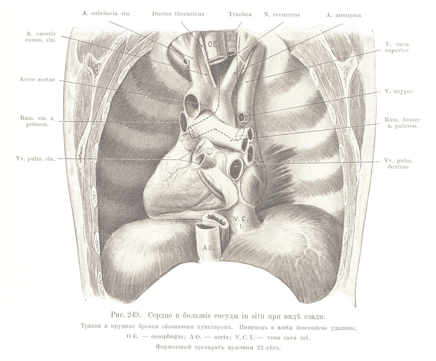 Сердце и большіе сосуды in situ при видѣ сзади. Трахея и крупные бронхи обозначены пунктиромъ. Пищеводъ и aorta descendens удалены.