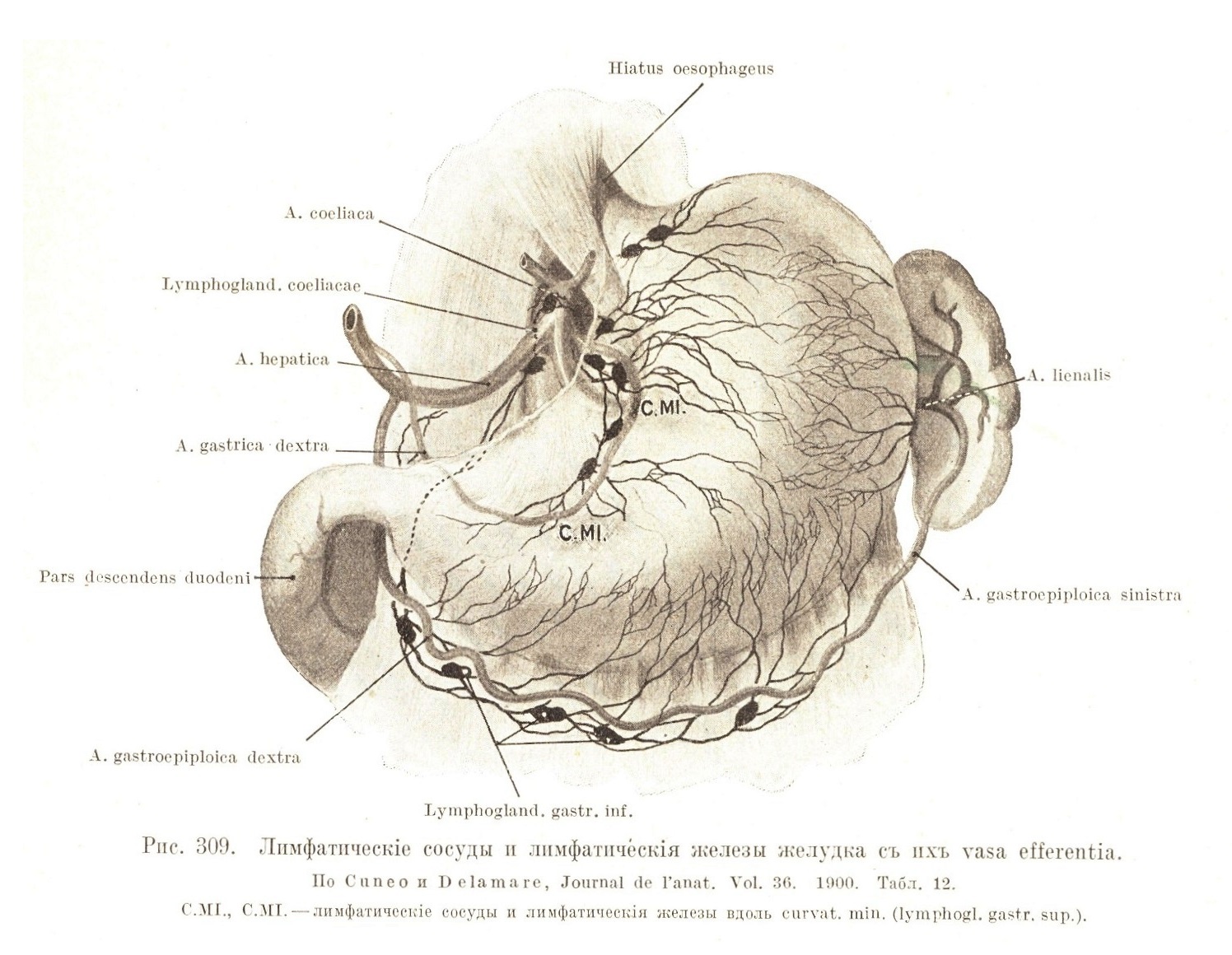 Лимфатическіе сосуды и лимфатическія железы желудка съ ихъ vasa efferentia.