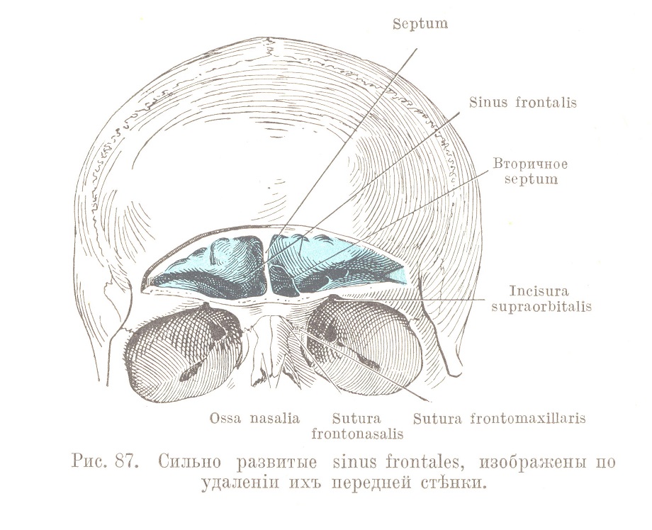 Сильно развитые sinus frontales, изображены по удаленіи ихъ передней стѣнки.