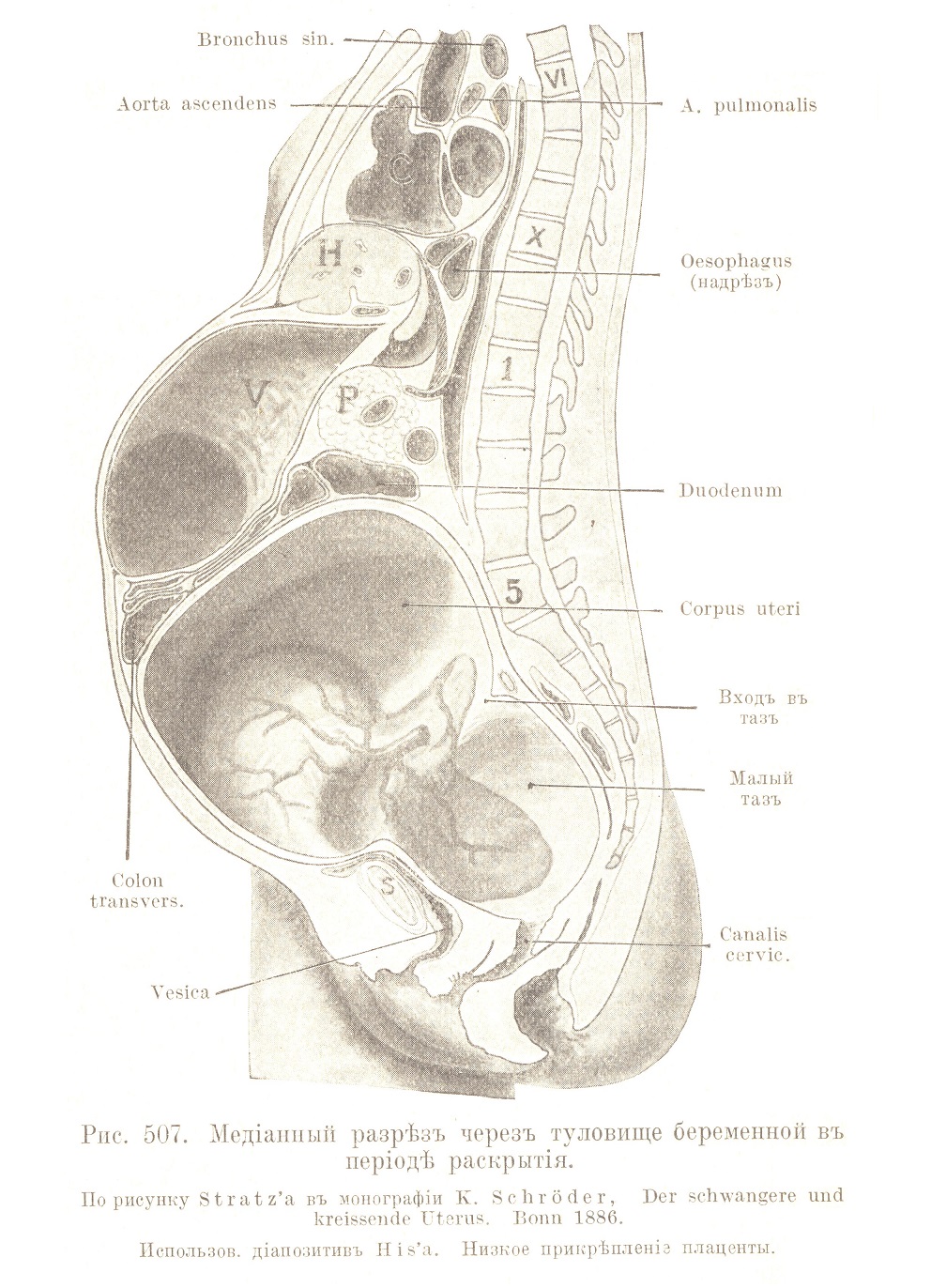 Топографія беременной и пуэрперальной матки