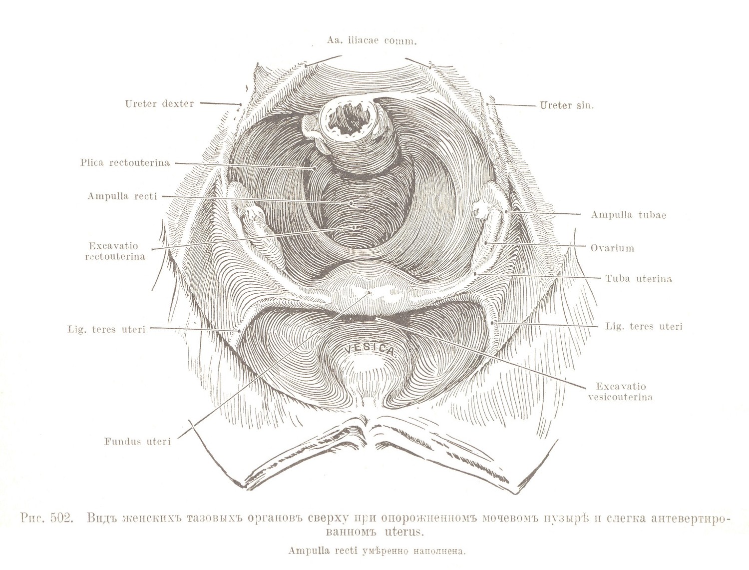 Видъ женскихъ тазовыхъ органовъ сверху при опорожненномъ мочевомъ пузырѣ и слегка антевертировайномъ uterus