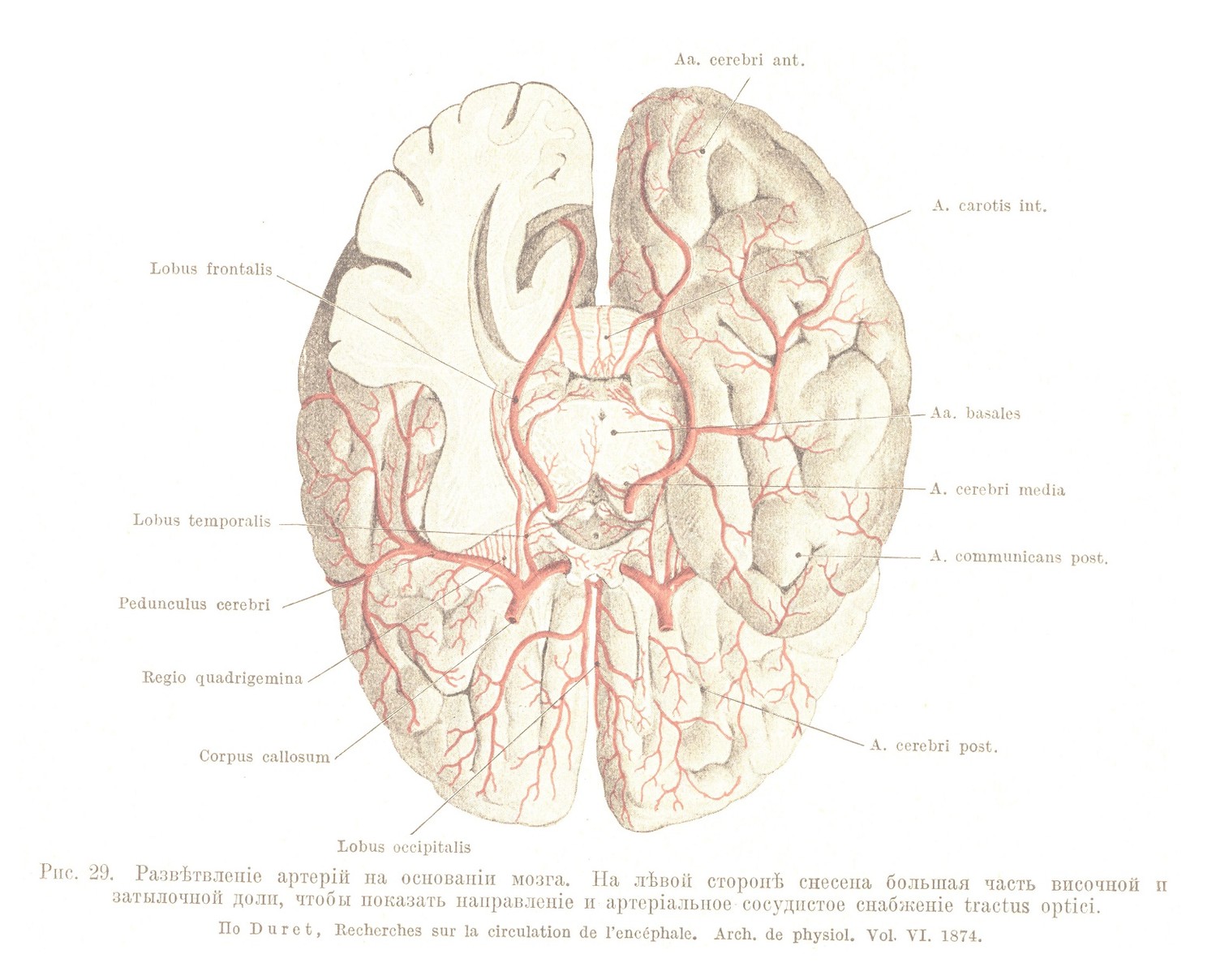 Развѣтвленіе артерій на основаніи мозга. На лѣвой сторонѣ снесена большая часть височной п затылочной доли, чтобы показать направленіе и артеріальное сосудистое снабженіе tractus optici.