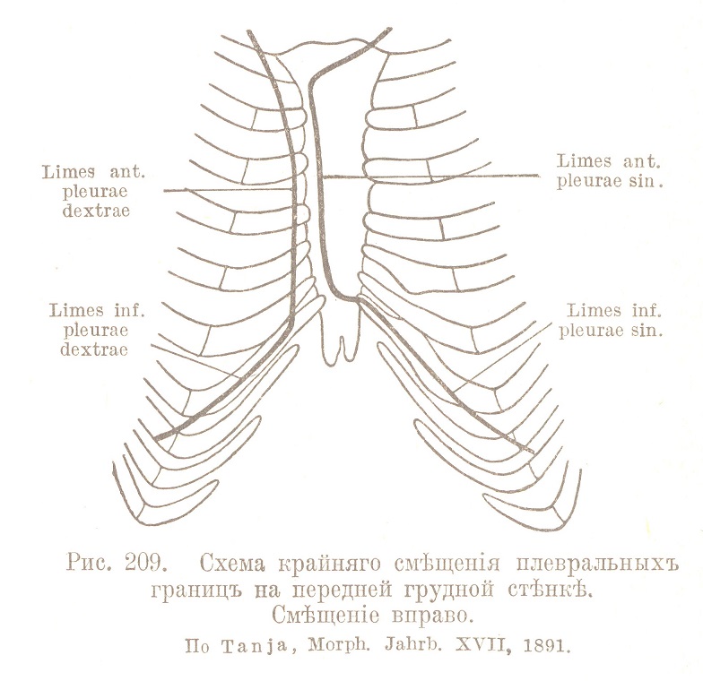 Схема крайняго смѣщенія плевральныхъ границъ на передней грудной стѣнкѣ. Смѣщеніе вправо
