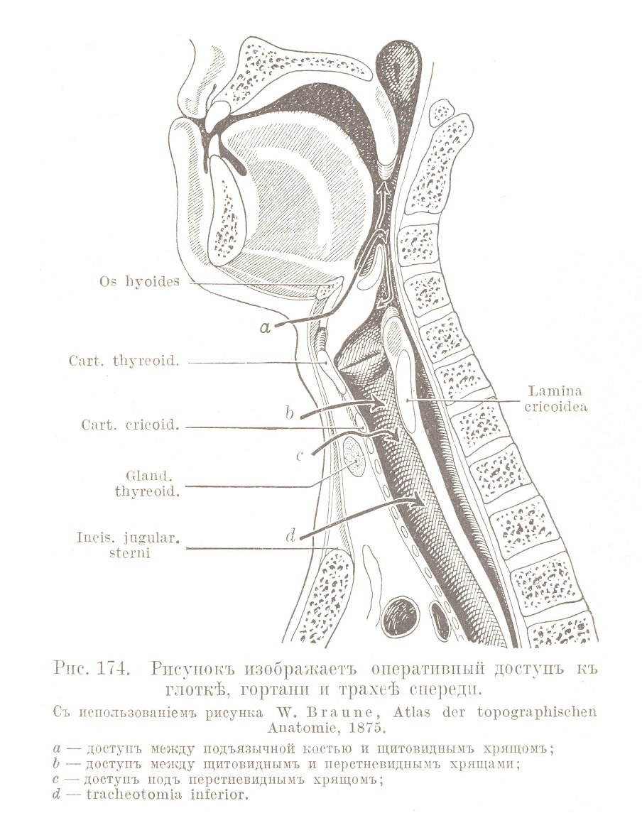 Рисунокъ изображаетъ оперативный доступъ къ глоткѣ, гортани и трахеѣ спереди. Съ использованіемъ рисунка W. Вгаune, Atlas der topographischen Anatomie, 1875