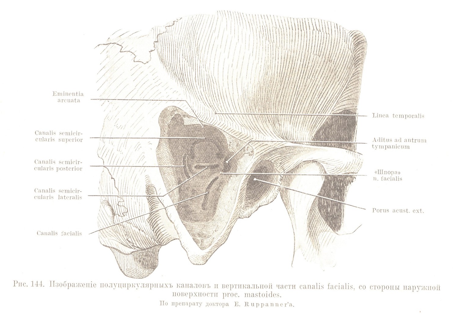 Изображеніе полуциркулярныхъ каналовъ и вертикальной части canalis facialis, со стороны наружной поверхности proc. mastoides. По препарату доктора Е. Ruppanner’a.