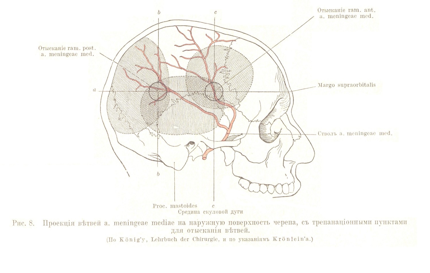 Проекція вѣтвей а. meningeae mediae на наружную поверхность черепа, съ трепанаціонными пунктами для отысканія вѣтвей.