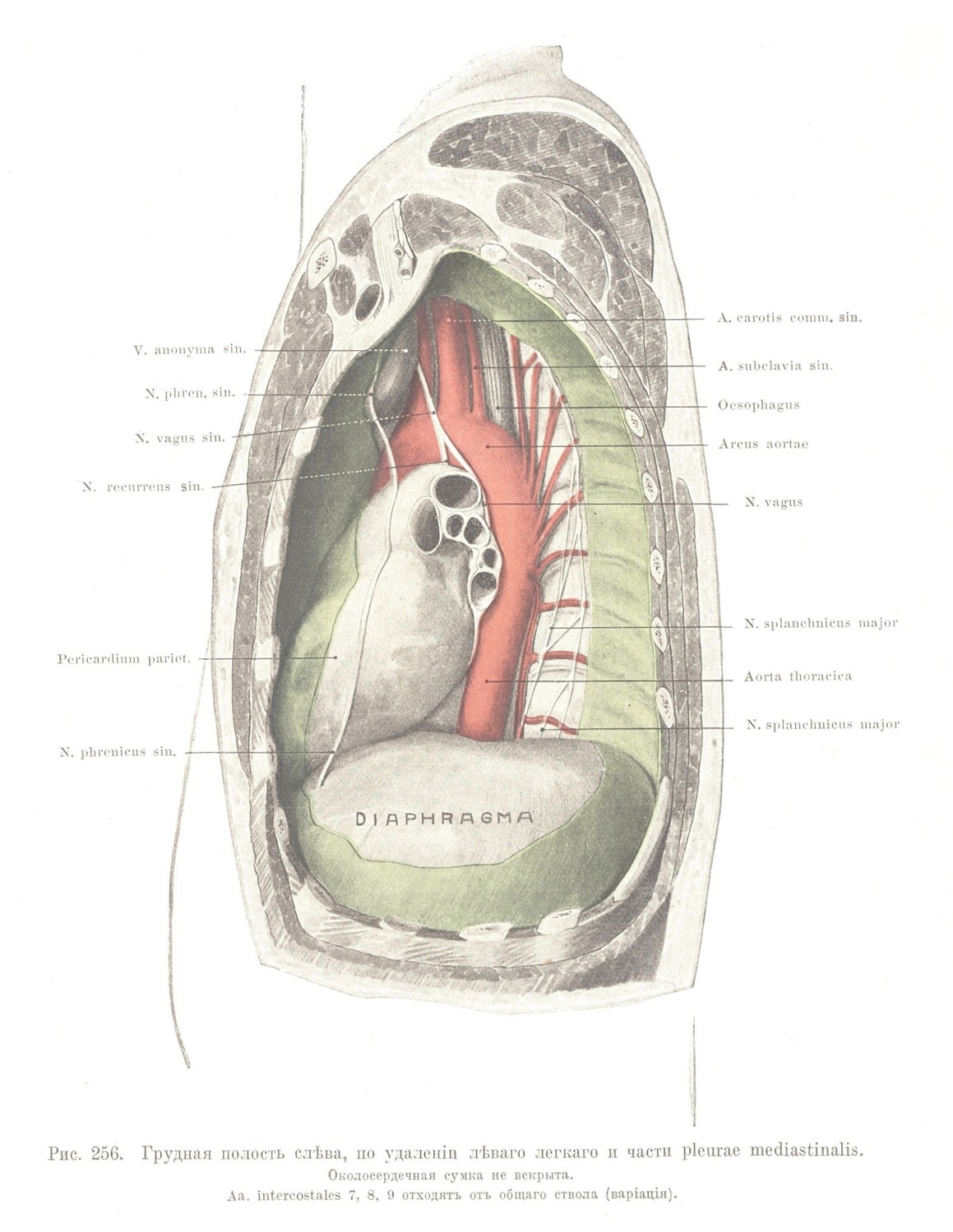 Грудная полость слѣва, по удаленіи лѣваго легкаго и части pleurae mediastinalis. Околосердечная сумка не вскрыта.