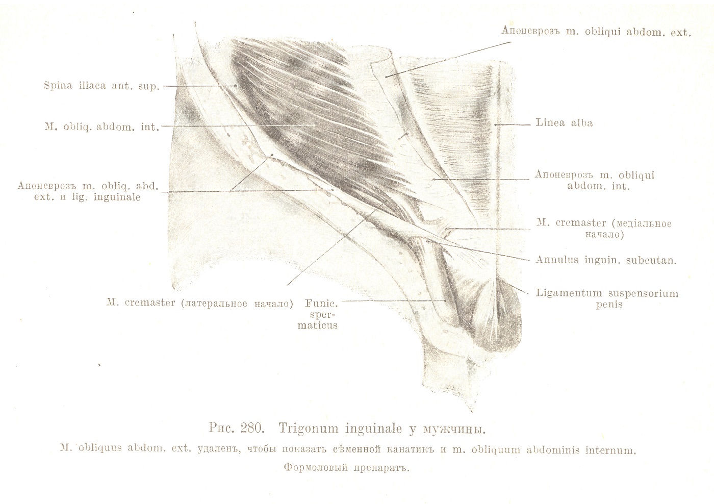Trigonum inguinale у мужчины.