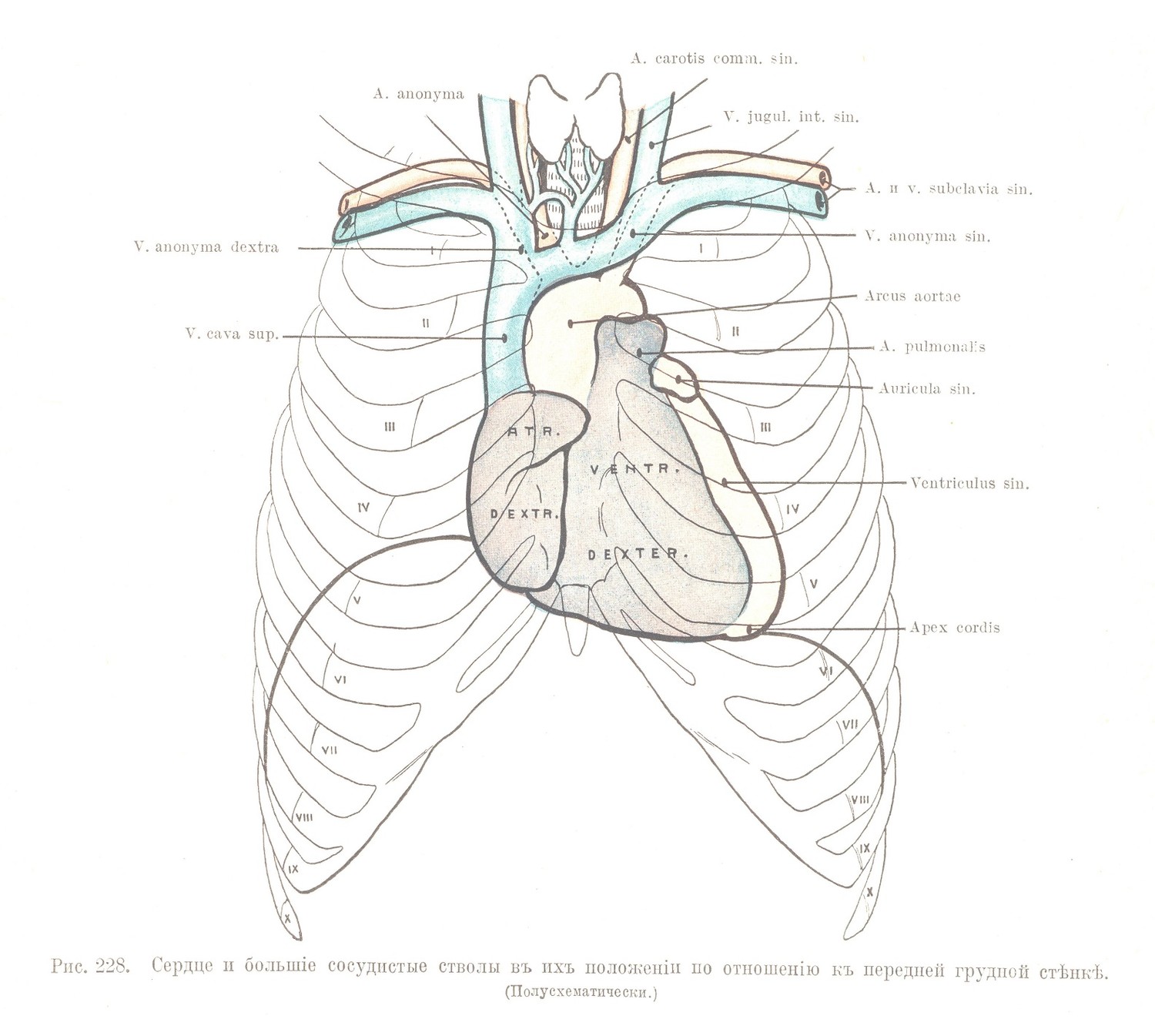 Сердце и большіе сосудистые стволы въ ихъ положеніи но отношенію къ передней грудной стѣнкѣ