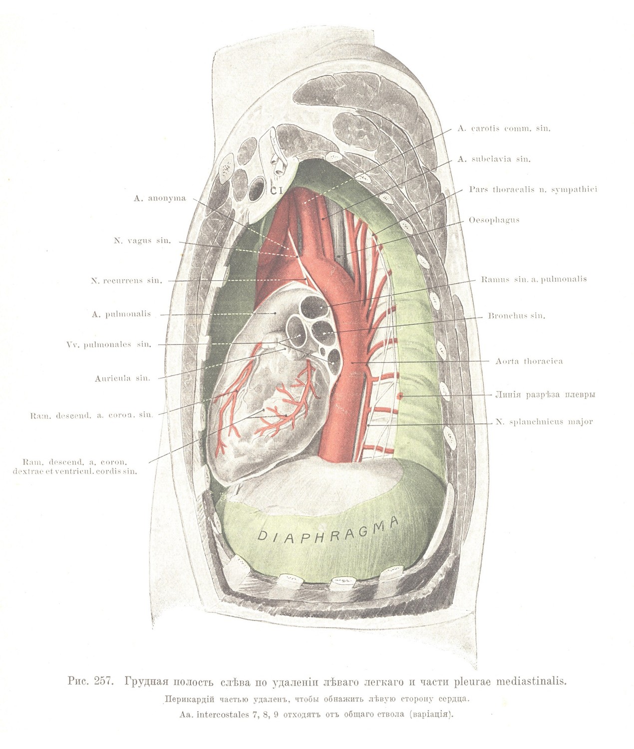 Грудная полость слѣва по удаленіи лѣваго легкаго и части pleurae mediastinalis