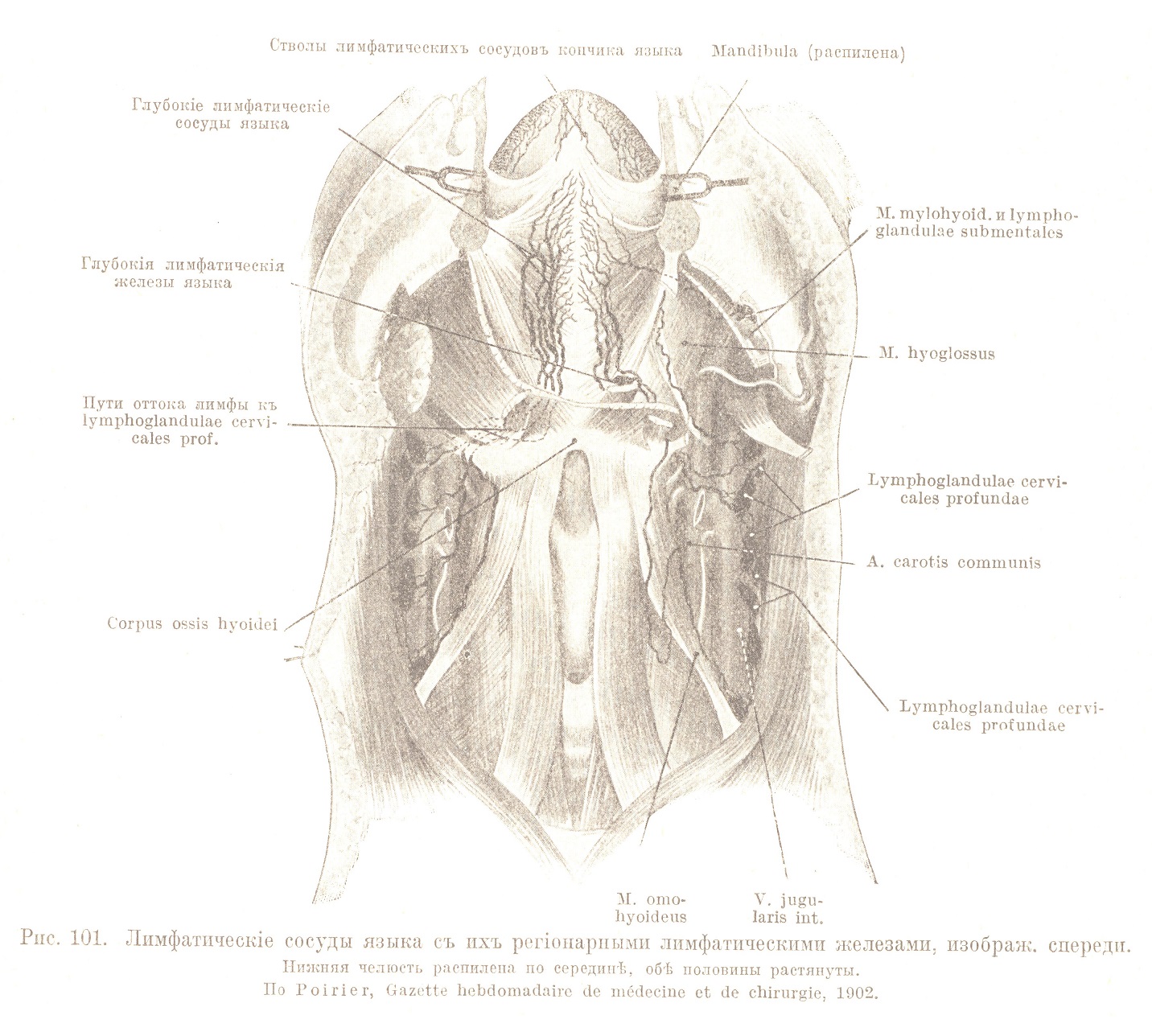 Лимфатическіе сосуды языка съ ихъ регіонарными лимфатическими железами, изображ. спереди. Нижняя челюсть распилена по серединѣ, обѣ половины растянуты.