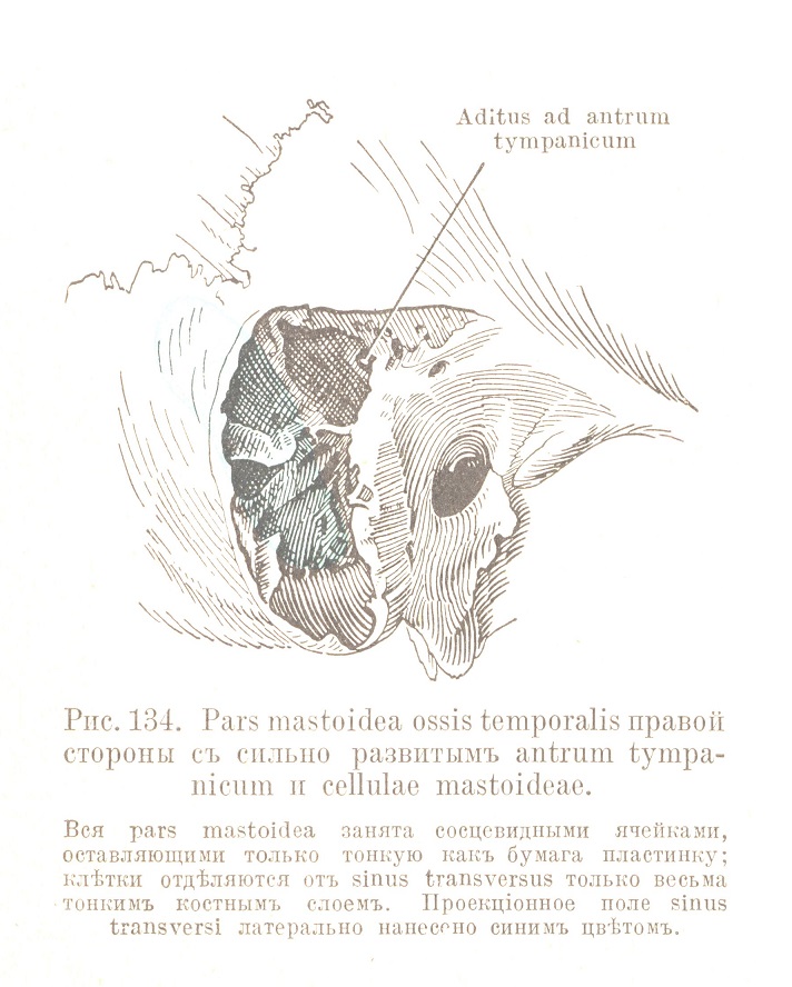 Pars mastoidea ossis temporalis правой стороны съ сильно развитымъ antrum tympanicum n cellulae mastoideae.