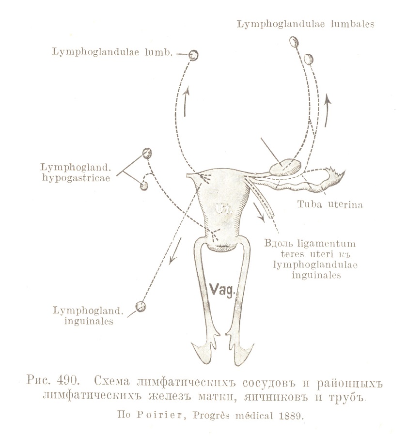 Схема лимфатическихъ сосудовъ и районныхъ лимфатическихъ железъ матки, яичниковъ и трубъ