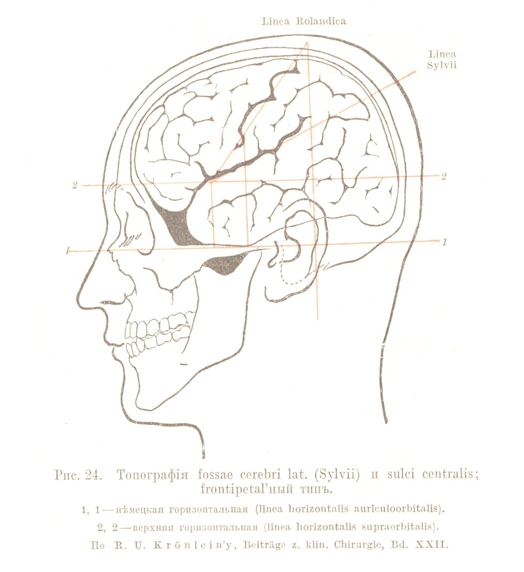 Топографія fossae cerebri lat. (Sylvii) и sulci centralis; frontipetal’ный типъ.