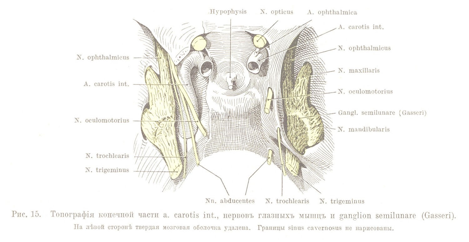 Топографія конечной части a. carotis int., нервовъ глазныхъ мышцъ и ganglion semilunare (Gasseri). На лѣвой сторонѣ твердая мозговая оболочка удалена. Границы sinus cavernosus не нарисованы.