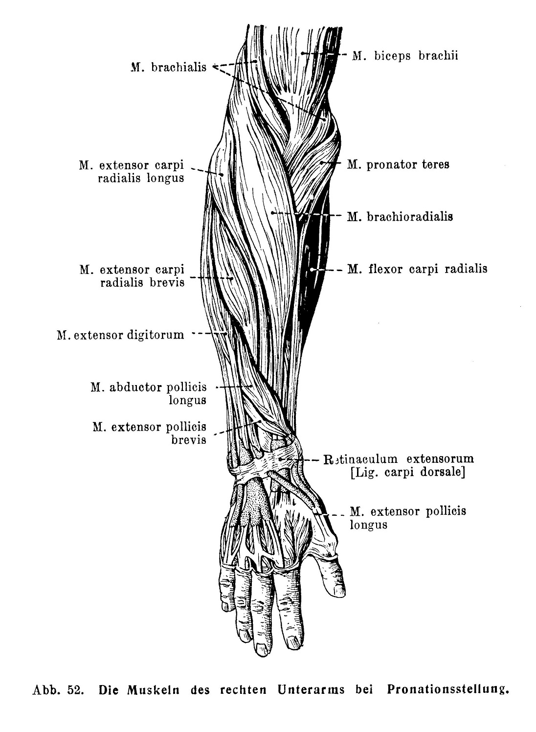 Die Muskeln des rechten Unterarms bei Pronationsstellung