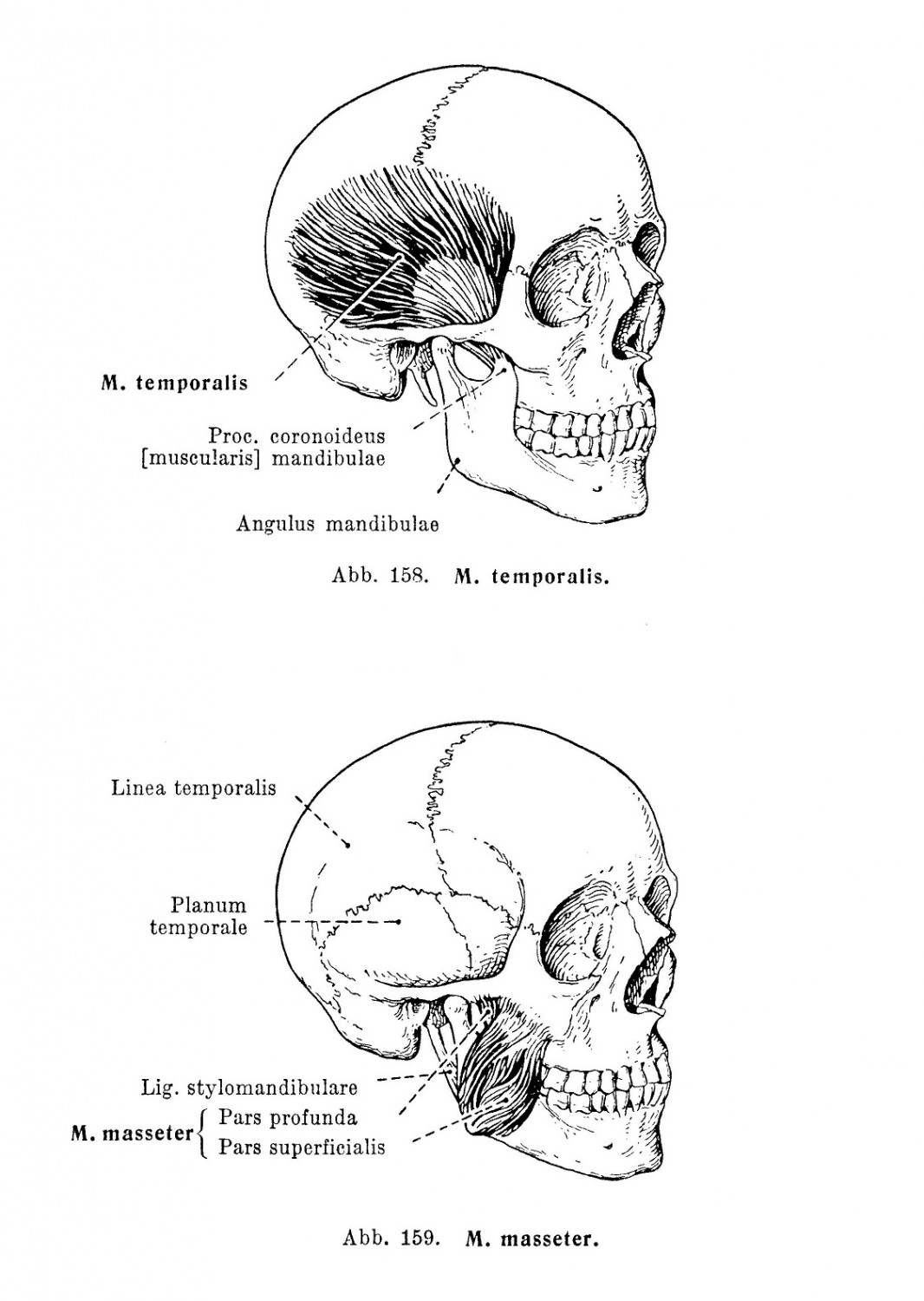 M. temporalis und M. masseter