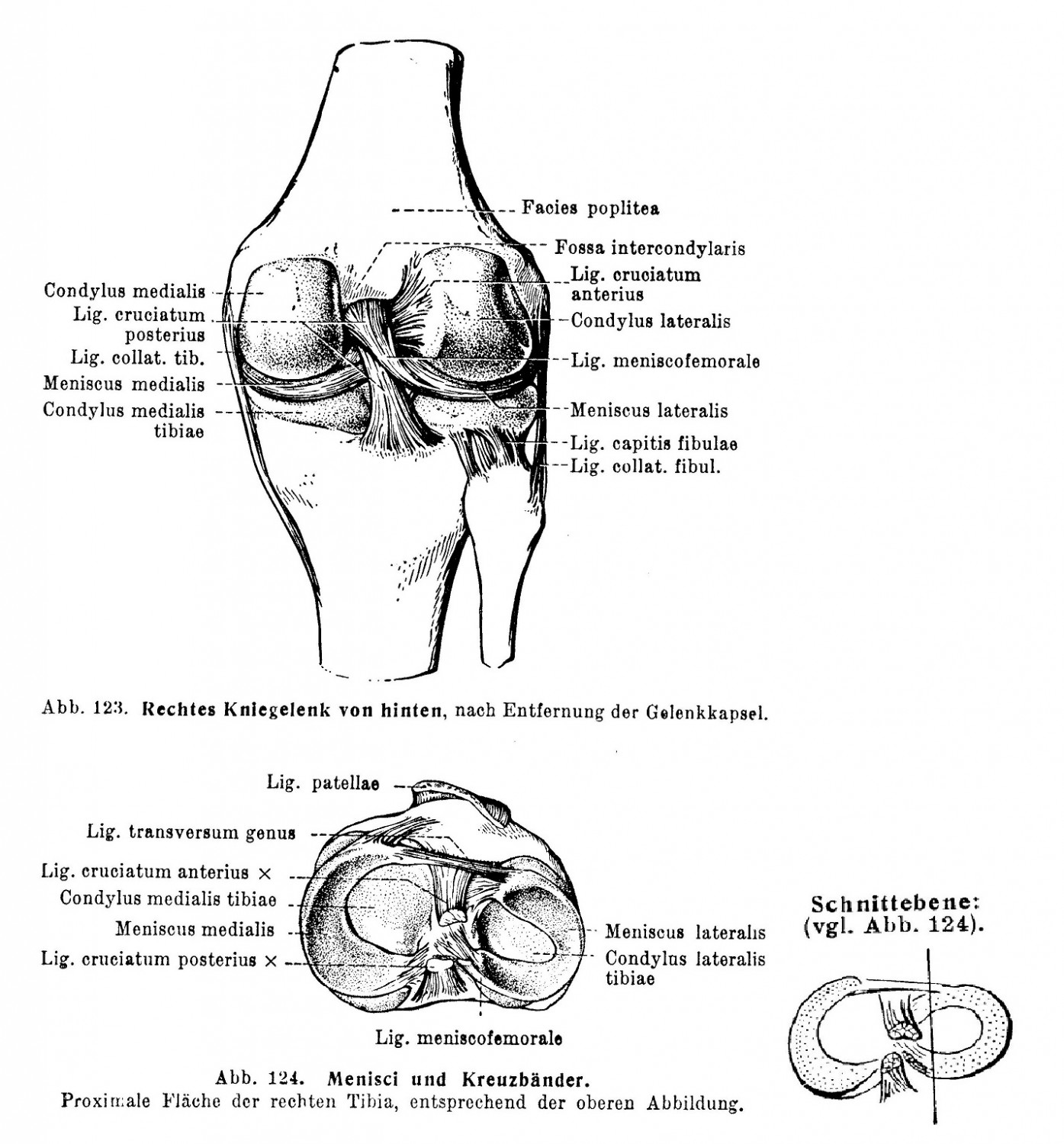 Rechtes Kniegelenk von hinten, nach Entfernung der Gelenkkapsel, Menisci und Kreuzbander