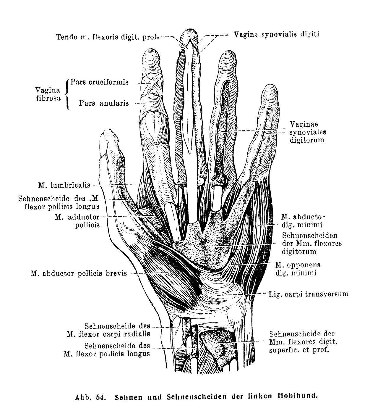 Sehnen und Sehnenscheiden der linken Hohlhand