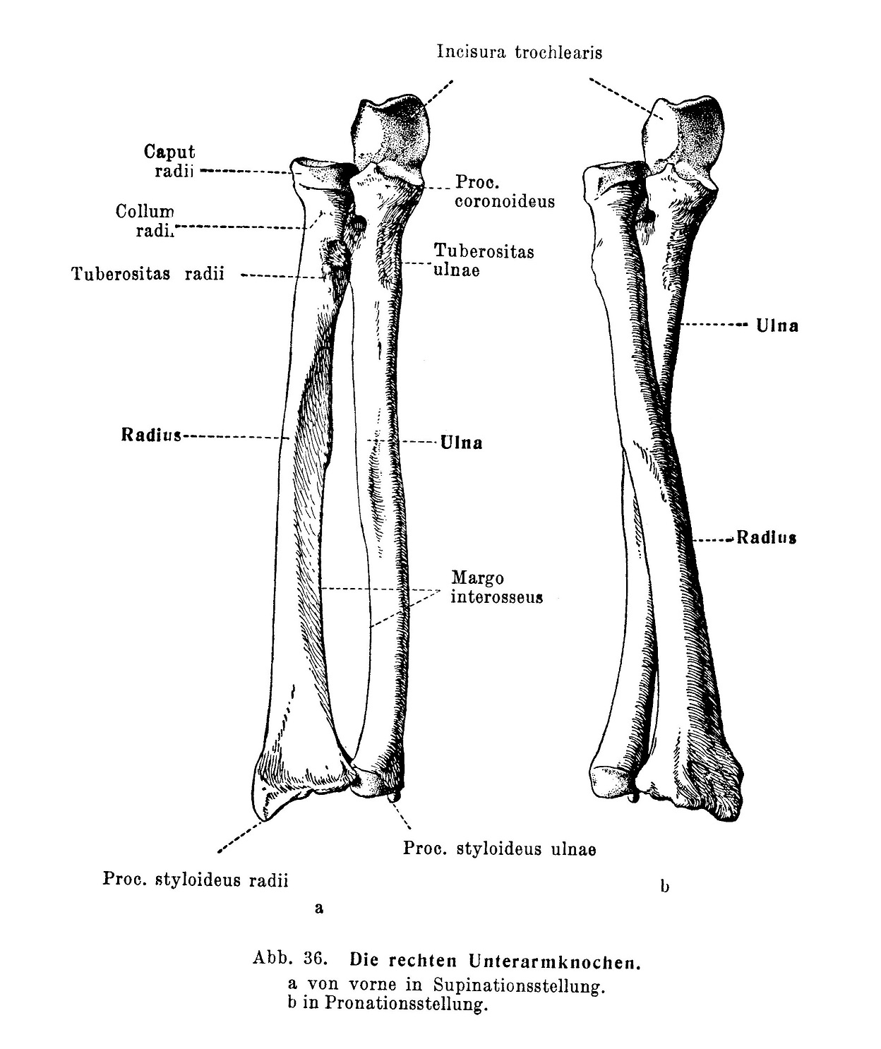 Die rechten Unterarmknochen