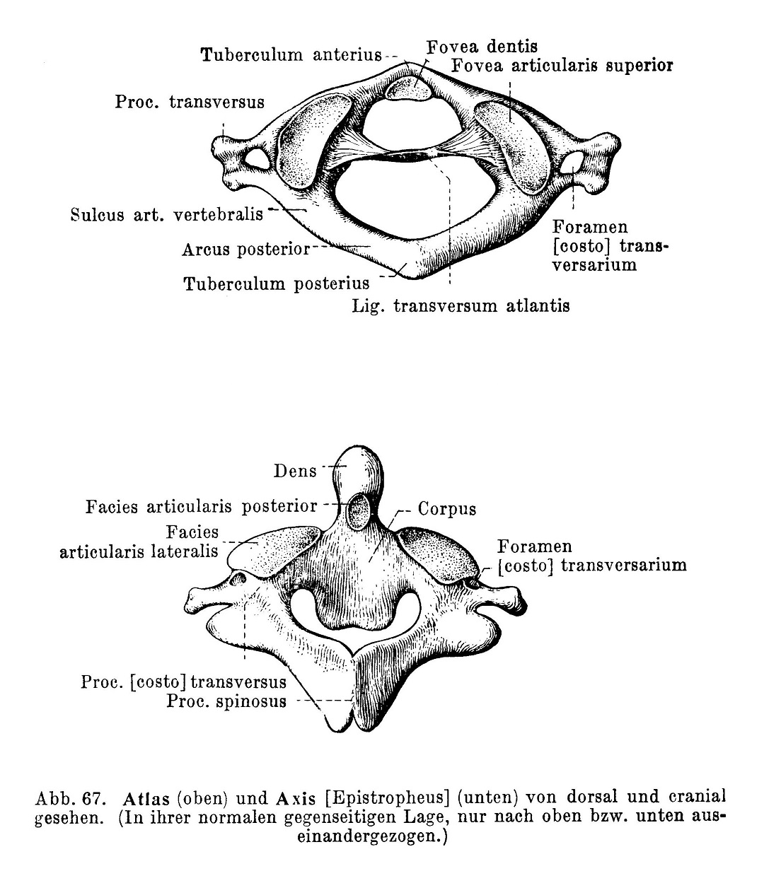 Atlas und Axis von dorsal und cranial gesehen