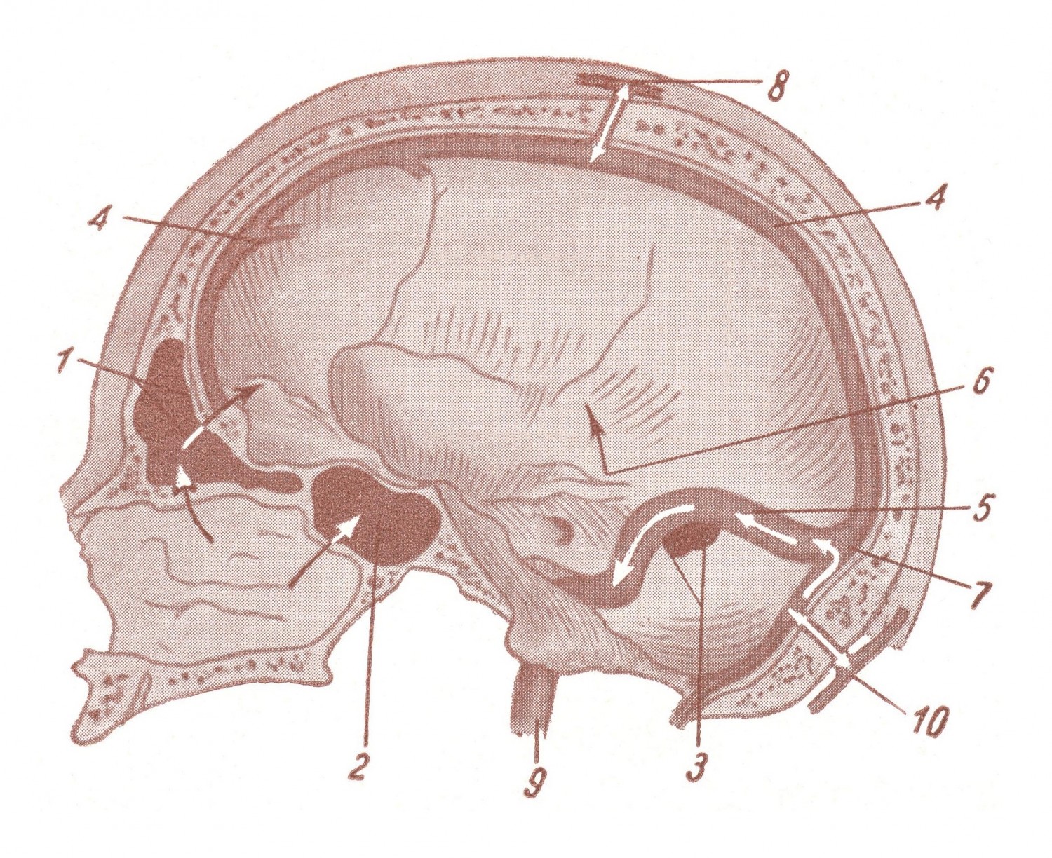 Схематическое изображение путей проникновения инфекции в черепную полость.