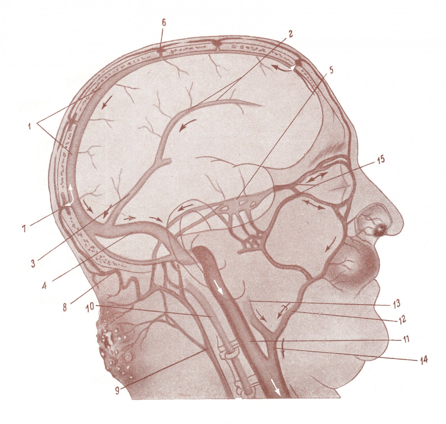 Пути проникновения инфекции в черепную полость из близлежащего фурункула или карбункула на лице или волосистой части головы.
