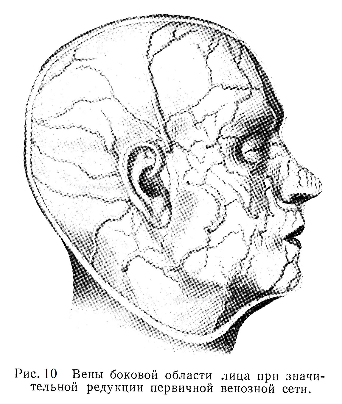 Вены боковой области лица при значительной редукции первичной венозной сети.