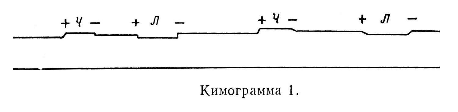 Кимограмма 1