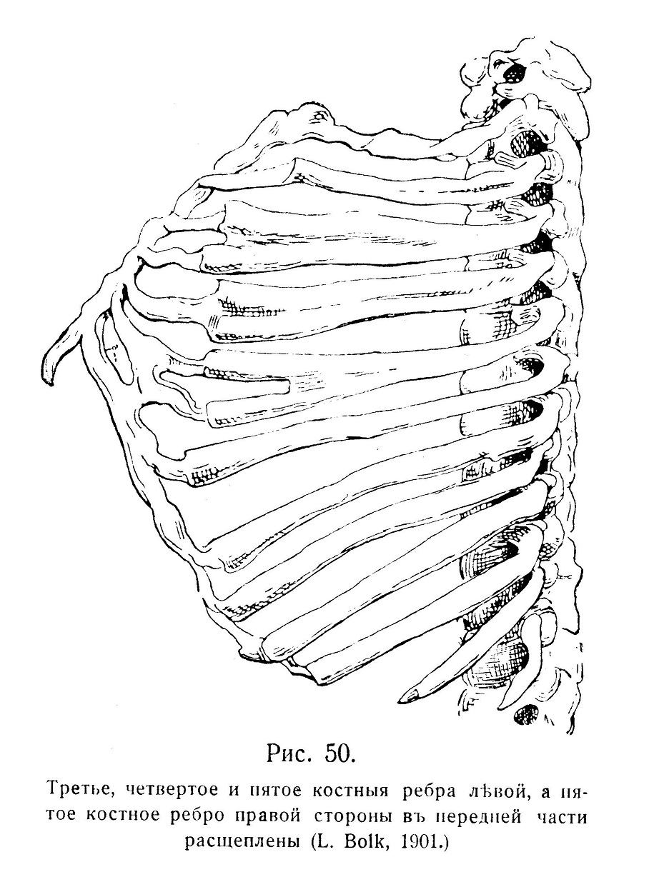 Третье, четвертое и пятое костныя ребра лѣвой, а пятое костное ребро правой стороны въ передней части расщеплены (L. Bolk, 1901.