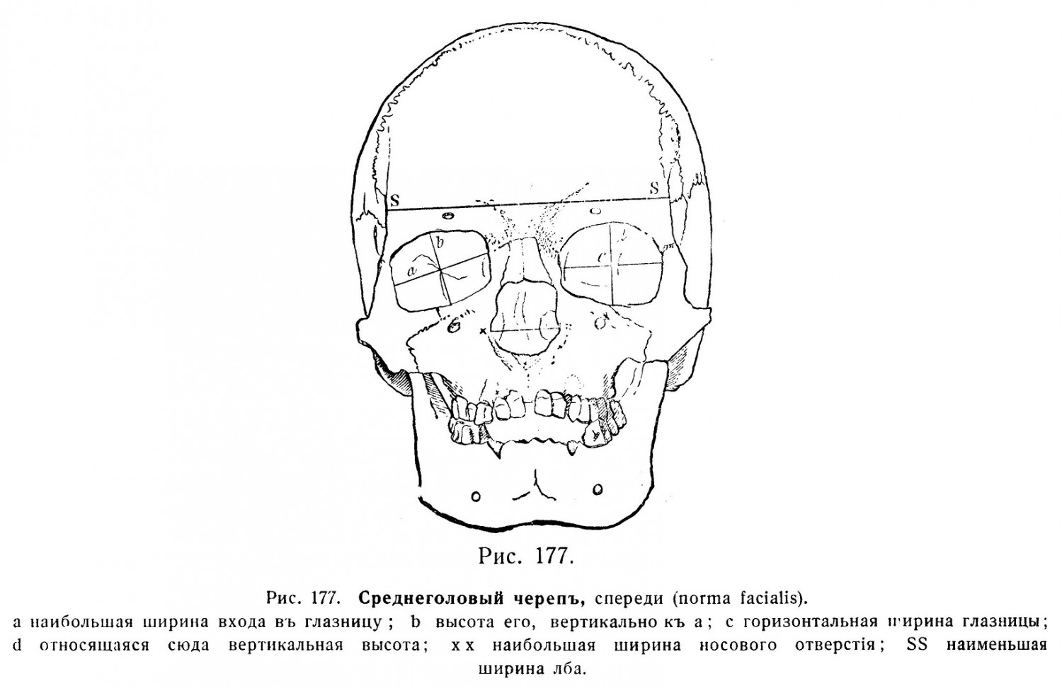 Среднеголовый черепъ, спереди (norma facialis)