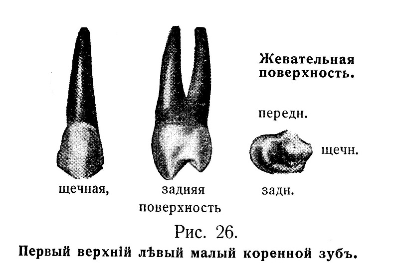 Первый верхний левый малый коренной зуб