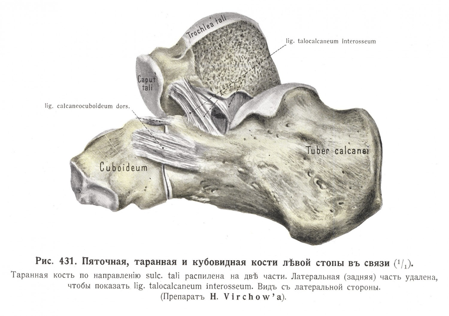 Пяточная, таранная и кубовидная кости левой стопы