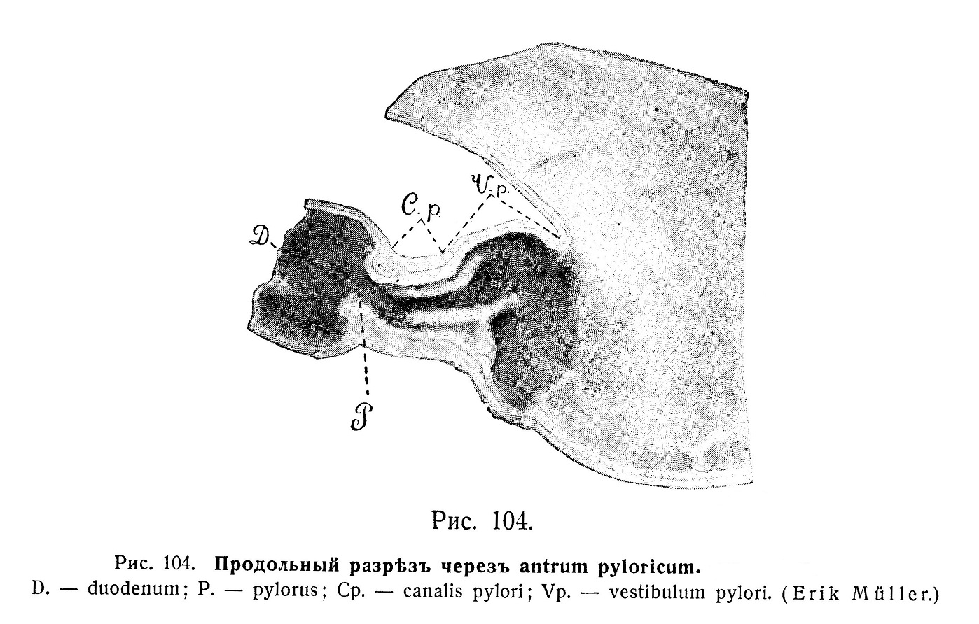 Продольный разрез через antrum pyloricum