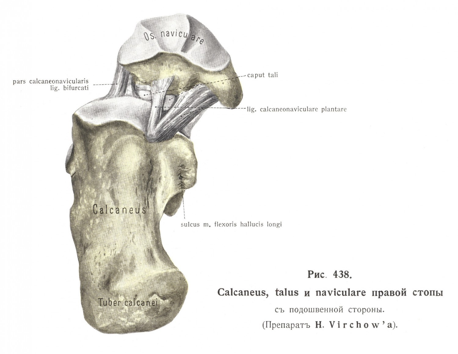 Calcaneus, talus, naviculare правой стопы с подошвенной стороны