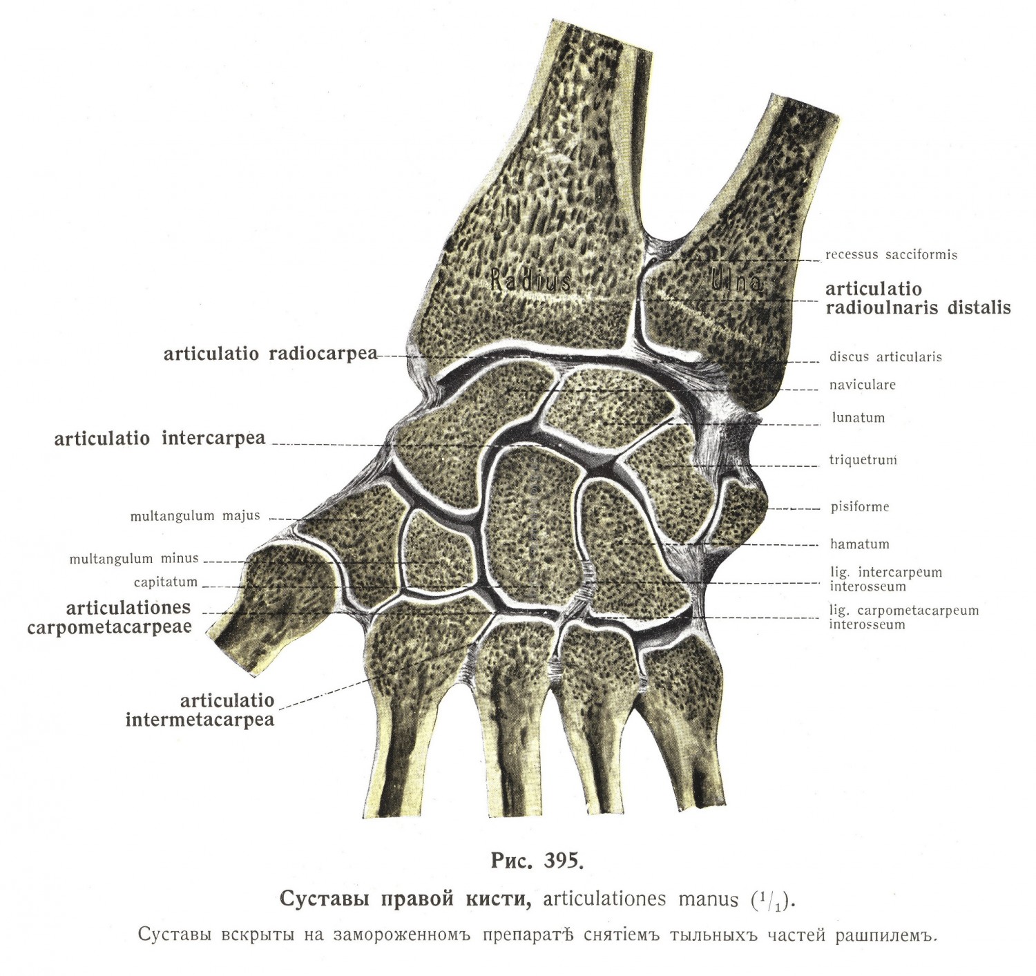 Суставъ гороховидной кости, articulatio ossis pisiformis