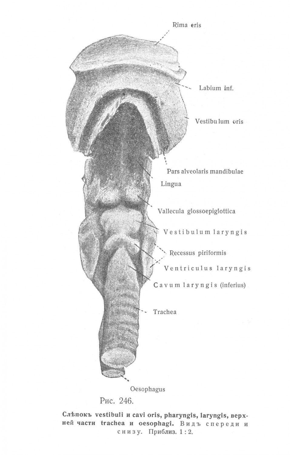 Слепок vestibuli и cavi oris, pharyngis, laryngis, верхней части trachea и oesophagi