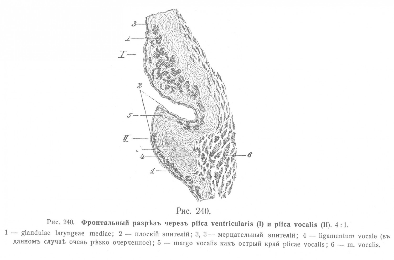 Фронтальный разрез через plica ventricularis и plica vocalis