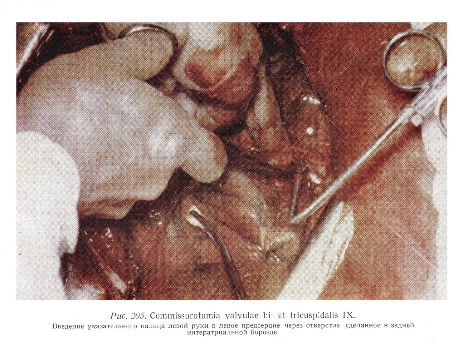 Хирургическая анатомия грудной клетки