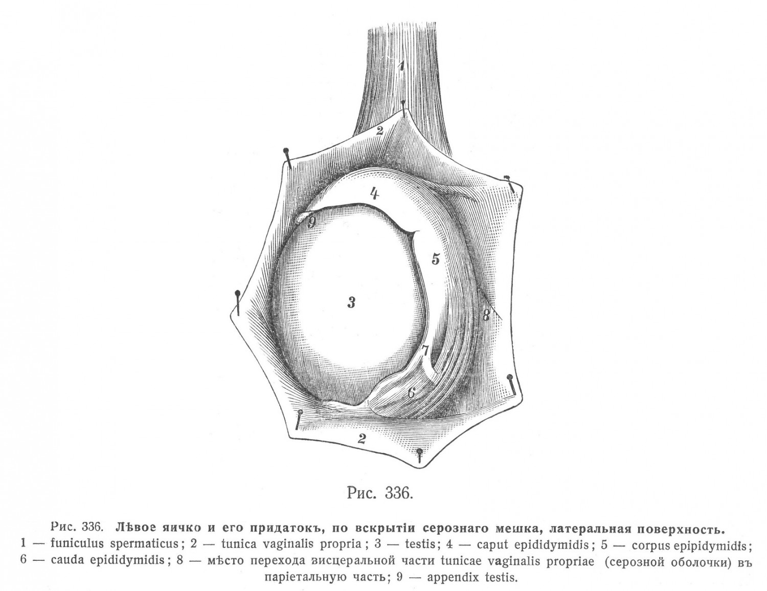 Левое яичко и его придаток, по вскрытии серозного мешка, латеральная поверхность