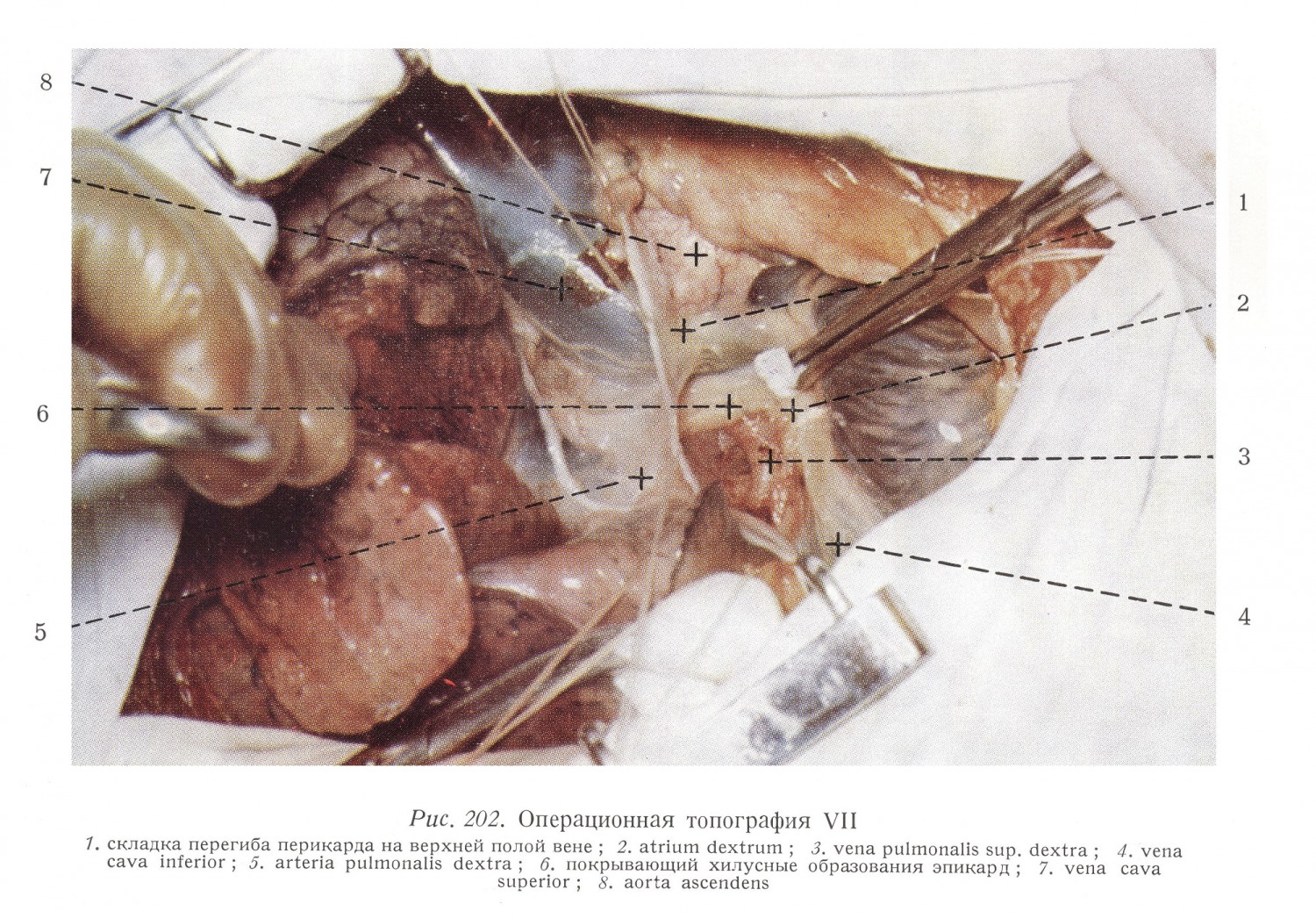 Хирургическая анатомия грудной клетки