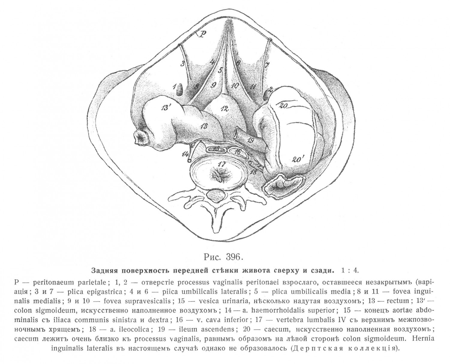 Брюшина, peritonaeum