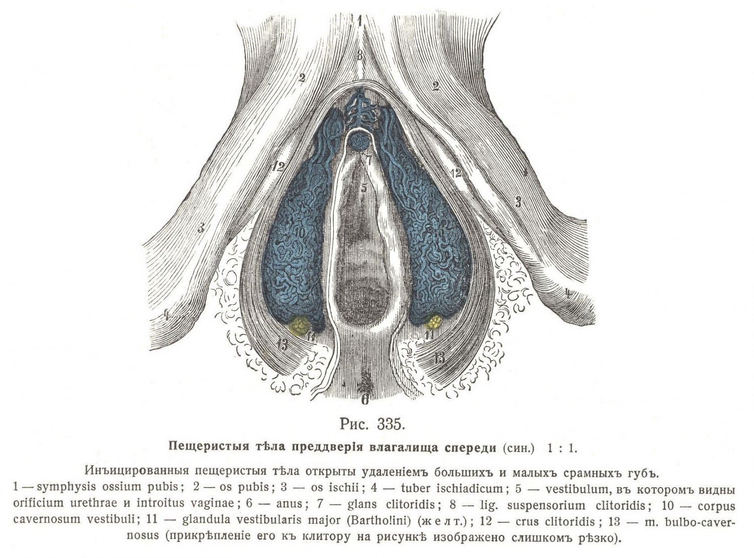 Бартолиніева железа, glandula vestibularis major (Bartholini)