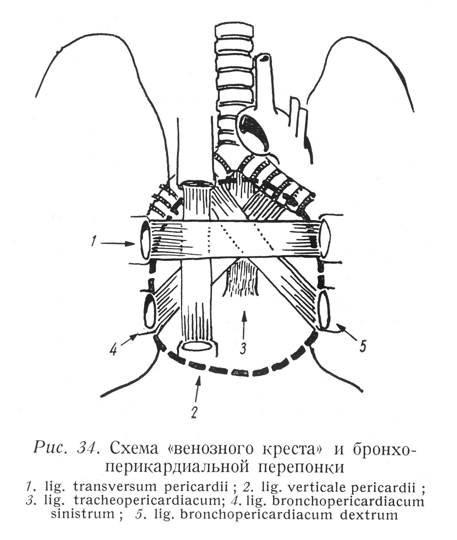 Схема «венозного креста» и бронхоперикардиальной перепонки
