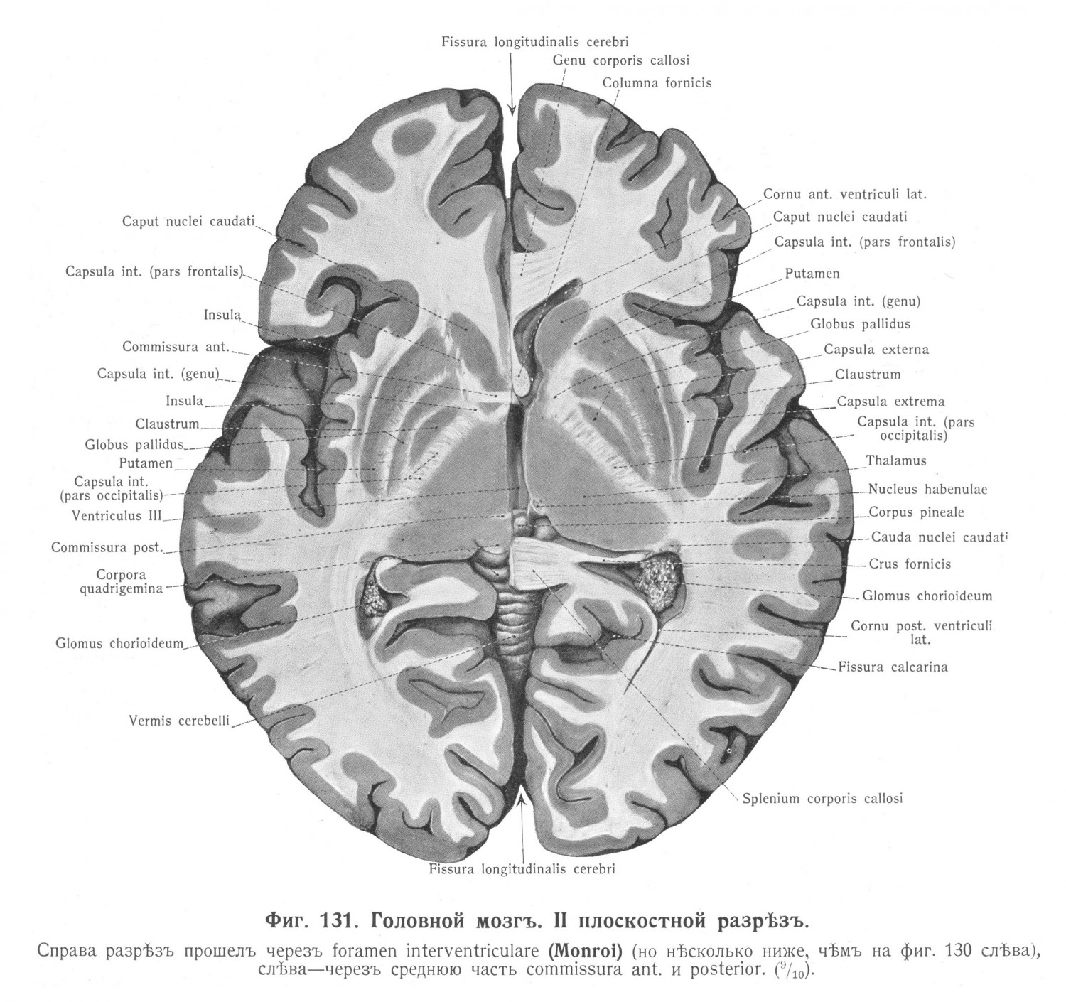 Головной мозг II плоский разрез