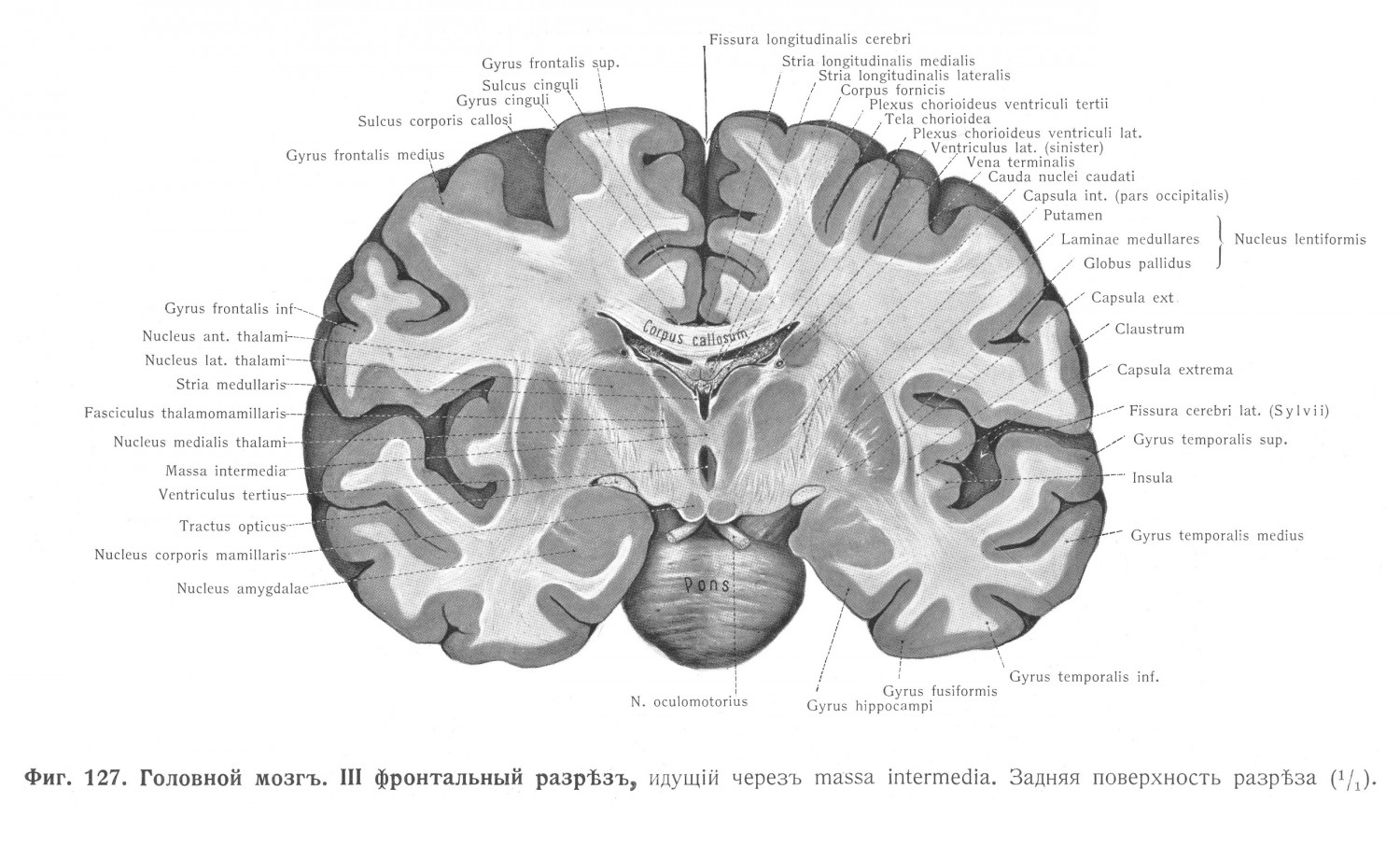 Головной мозг III фронтальный разрез